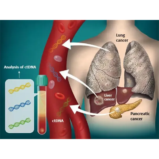 LiquiCore Lung Panel